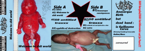 Anasarque Birth But Dead : Welcome to Shit World